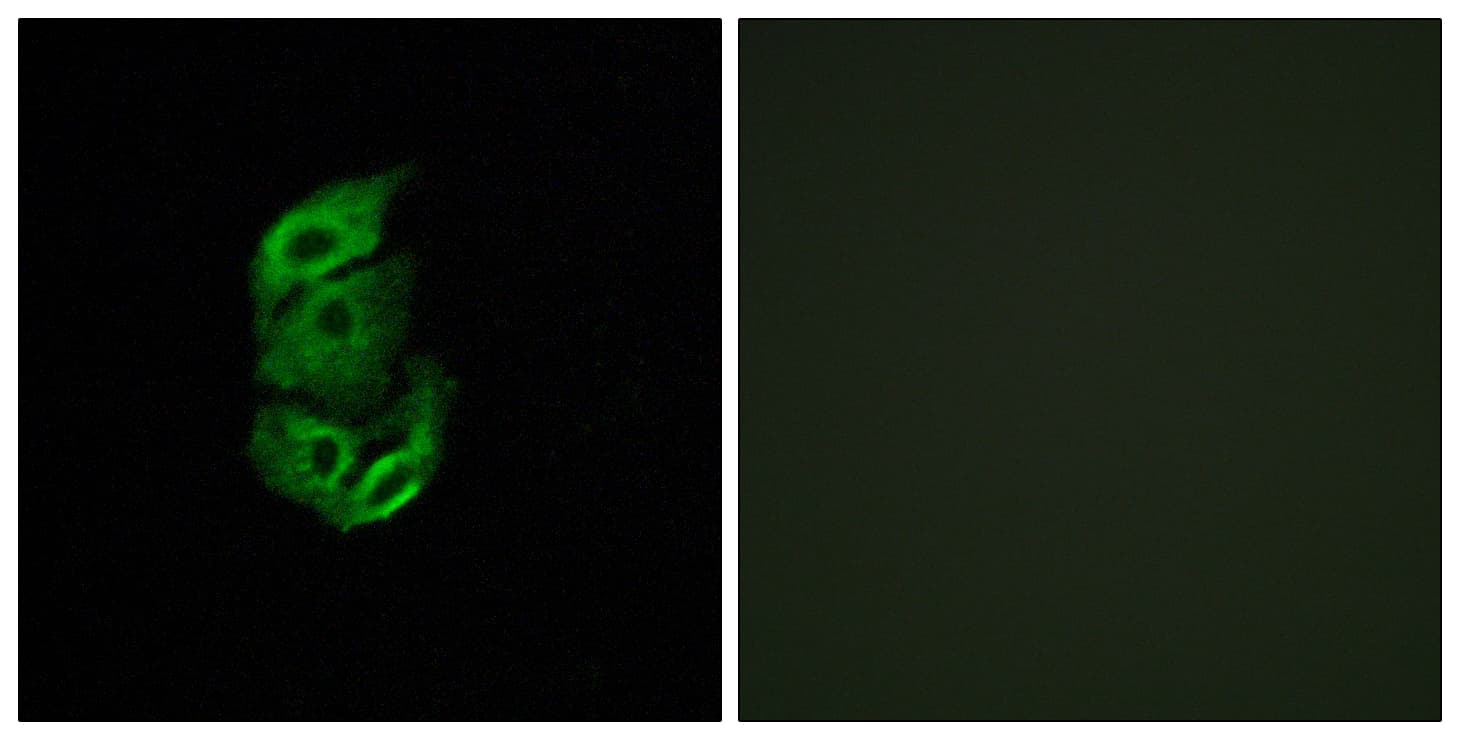 Polyclonal Rabbit anti-Human STARD13 Antibody (aa101-150, IF)