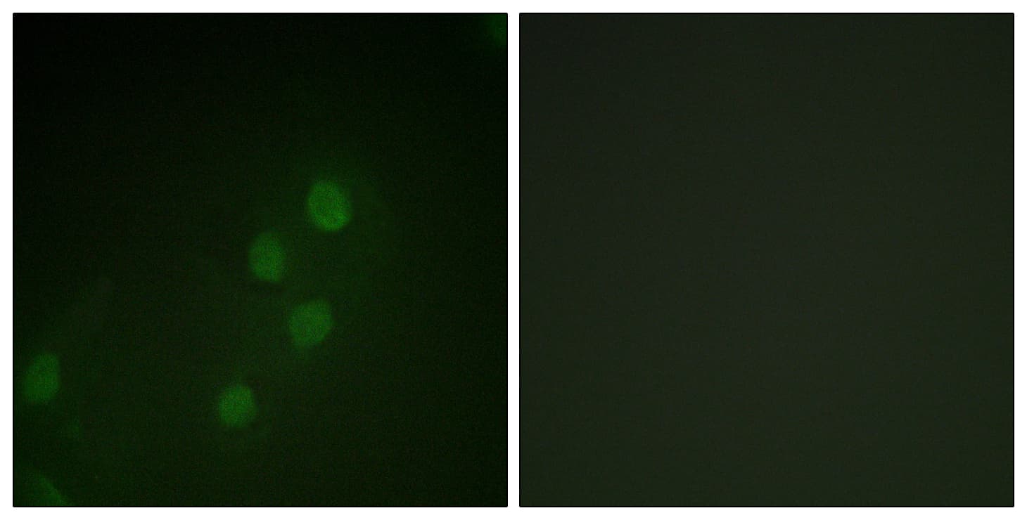 Polyclonal Rabbit anti-Human MYF5 / MYF 5 Antibody (aa21-70, IHC, IF, WB)