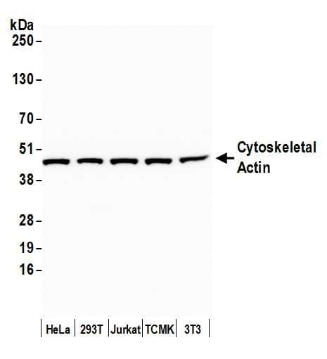 Polyclonal Rabbit anti-Human ACTG1 / Gamma Actin Antibody (N-Terminus, IHC, WB)