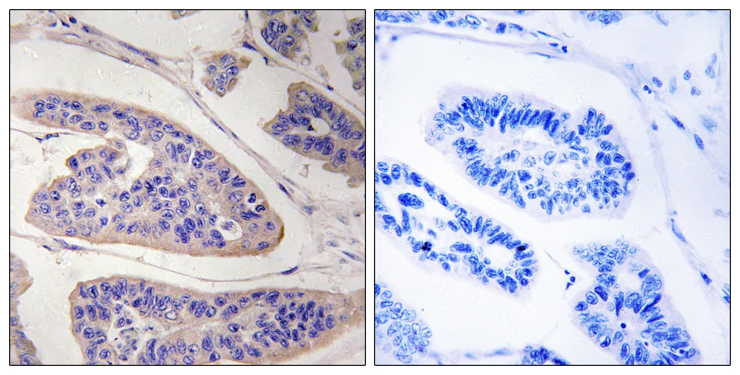 ENAH / MENA Antibody (aa472-521)