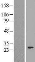 HAUS2 Protein (Over-Expression Lysate Myc-DDK (Flag))