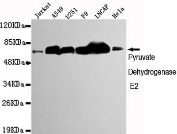 Monoclonal Mouse anti-Human DLAT / PDC-E2 Antibody (WB)