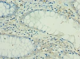 IL36RN / IL1F5 Antibody (aa1-155)