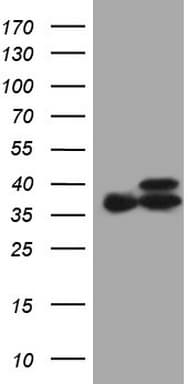 ETFA Antibody (clone OTI5C4, Carrier-free)