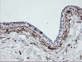 F13A1 / Factor XIIIa Antibody (clone OTI3F1)