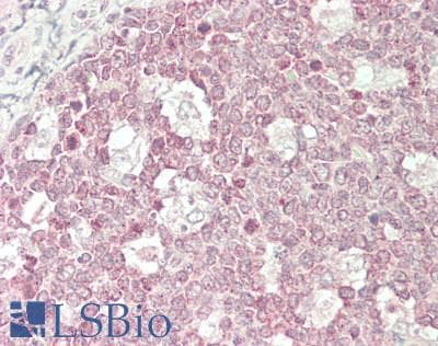 IHC-plus™ TEFM Antibody