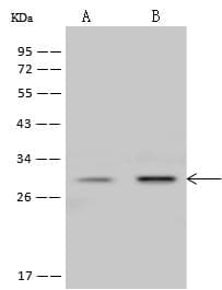 PRNP / PrP / Prion Antibody