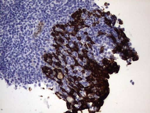 KRT19 / CK19 / Cytokeratin 19 Antibody (aa240-390, clone OTI1C11)