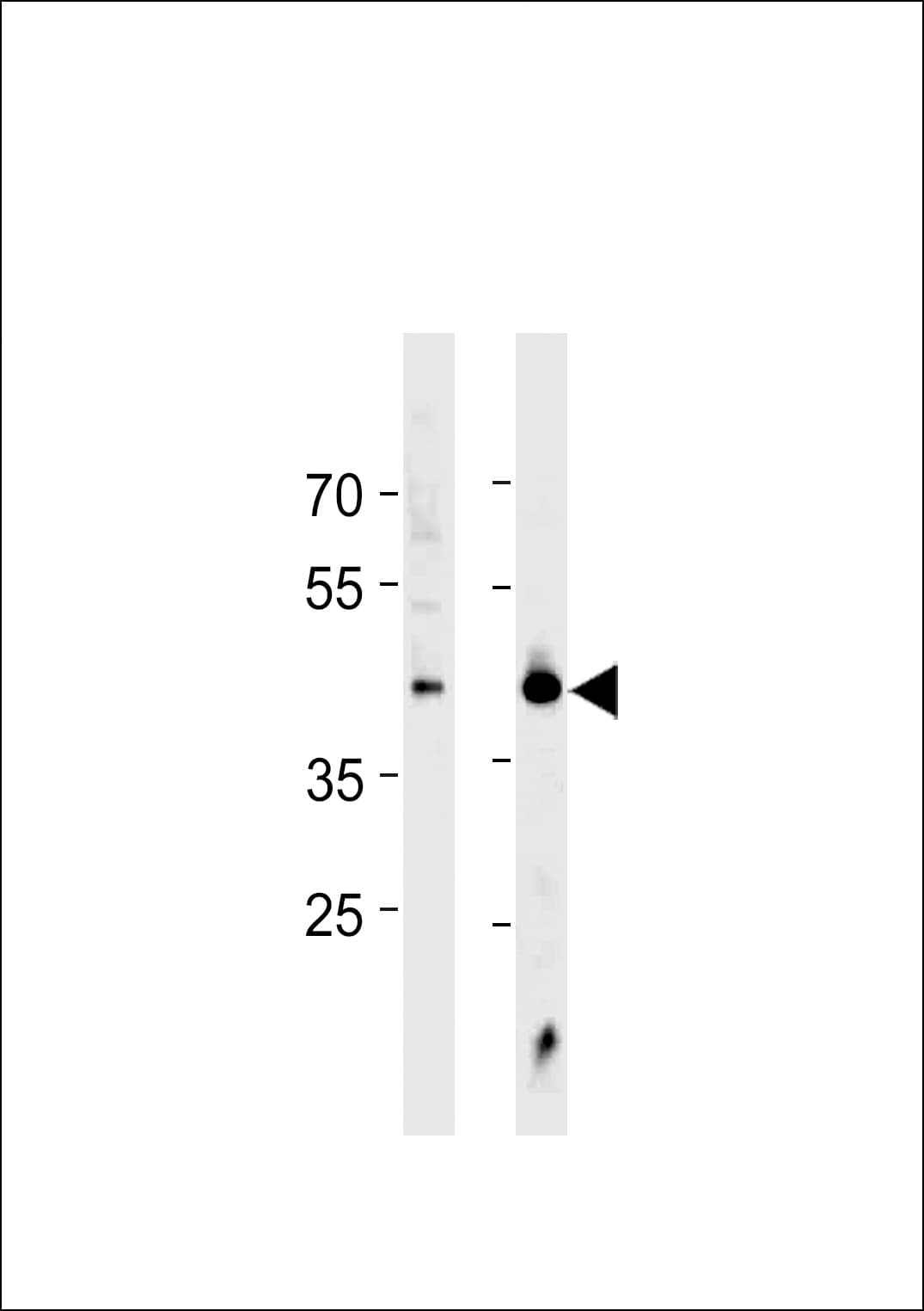 HSF1 Antibody (aa278-309)