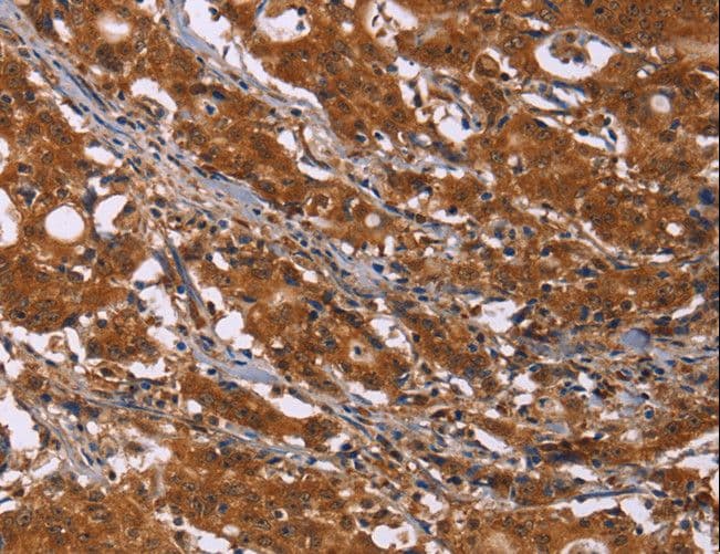 Polyclonal Rabbit anti-Human DCBLD2 Antibody (IHC)