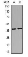 Polyclonal Rabbit anti-Human ELAVL3 / HUC Antibody (IHC, WB)