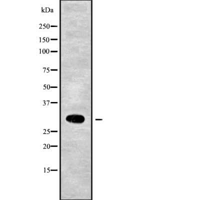 Polyclonal Rabbit anti-Human MRPL28 Antibody (IHC, WB)