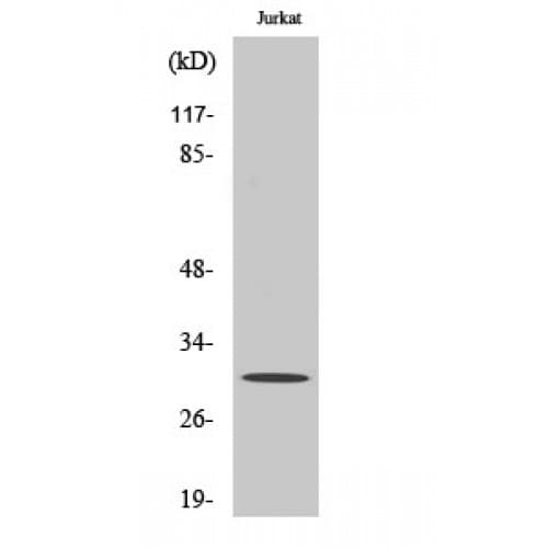 ATF5 Antibody (190-270 aa, C-terminal)