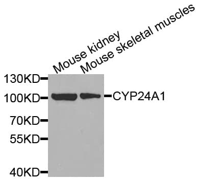 CYP24 / CYP24A1 Antibody