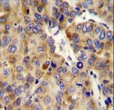 Endostatin Antibody (aa1311-1339)