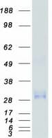 Human CD63 Protein (Recombinant Myc-DDK (Flag))
