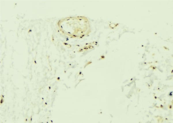 ZNF592 Antibody