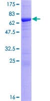 Human CSNK2A1 Protein (Recombinant GST)