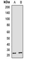 Polyclonal Rabbit anti-Human HBEGF / HB EGF Antibody (WB)