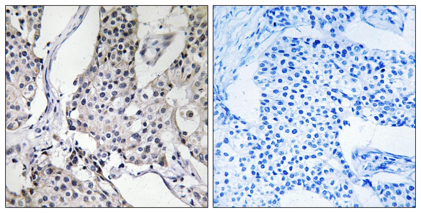 PHLDA3 Antibody