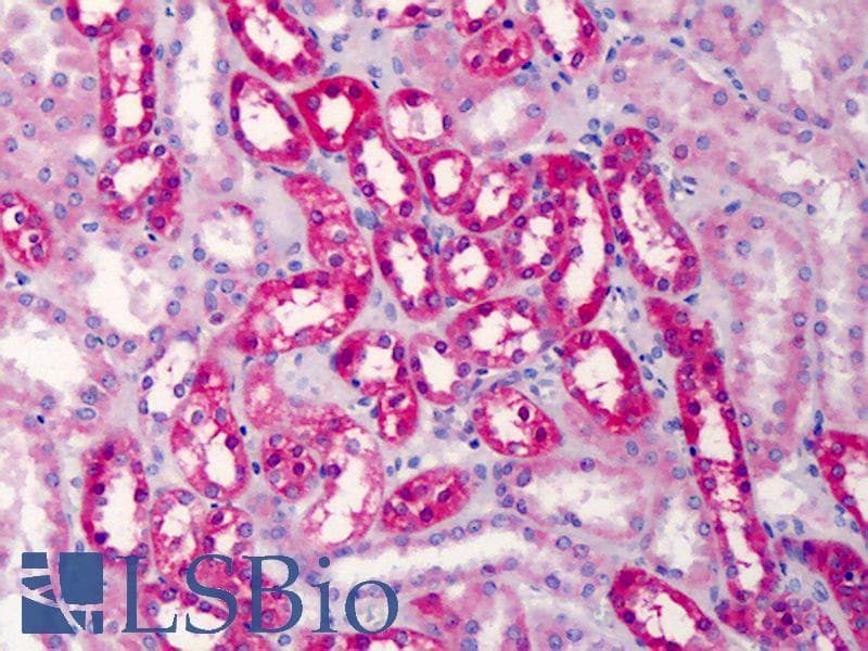 IHC-plus™ Polyclonal Goat anti-Human COMT Antibody (aa52-65, IHC, WB)