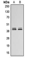 Polyclonal Rabbit anti-Human ERK1 + ERK2 Antibody (Internal, WB)