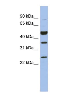 MAGEB3 Antibody (aa35-84)