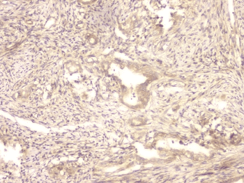 Polyclonal Rabbit anti-Human BMP15 Antibody (IHC, WB)
