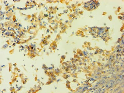 HNRNPH1 / hnRNP H Antibody (aa2-449)