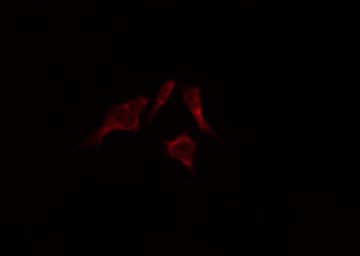 Polyclonal Rabbit anti-Human EPHB6 / EPH Receptor B6 Antibody (IHC, IF, WB)