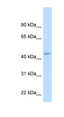 Polyclonal Rabbit anti-Human NR1I3 / CAR Antibody (N-Terminus, IHC, WB)