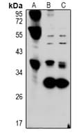 FGL1 / Hepassocin Antibody