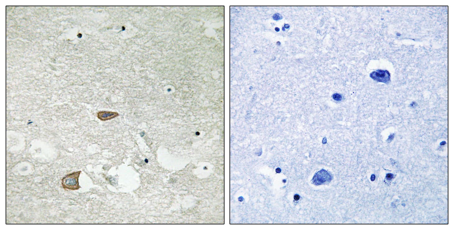 Polyclonal Rabbit anti-Human CELSR2 Antibody (aa2781-2830, IHC, IF)