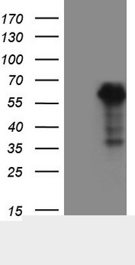 Monoclonal Mouse anti-Human WTAP Antibody (clone OTI12G7, aa2-106, IHC, WB)