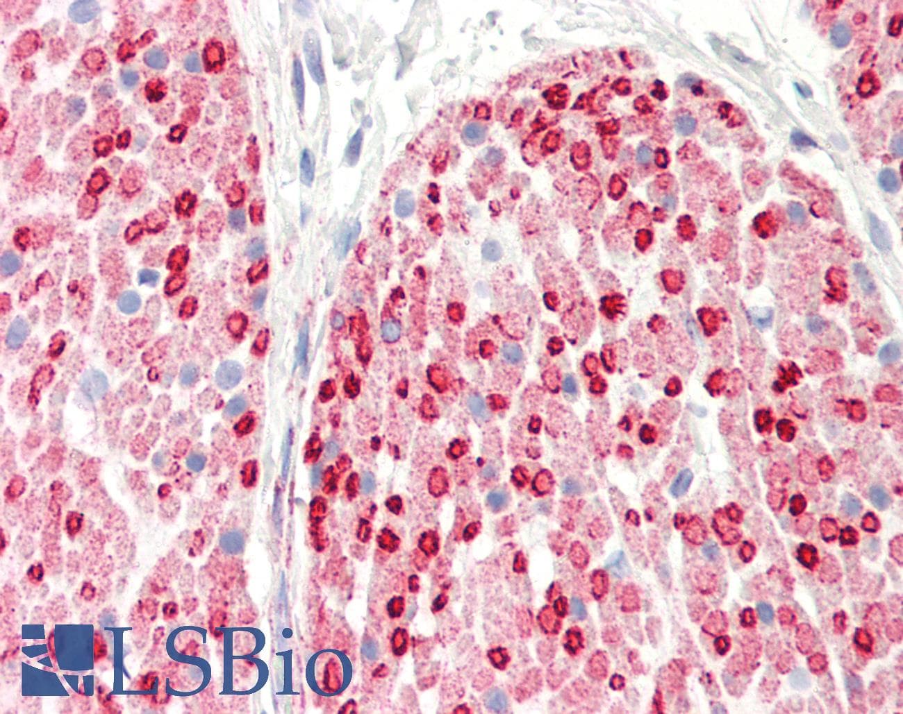 PathPlus™ CALD1 / Caldesmon Antibody