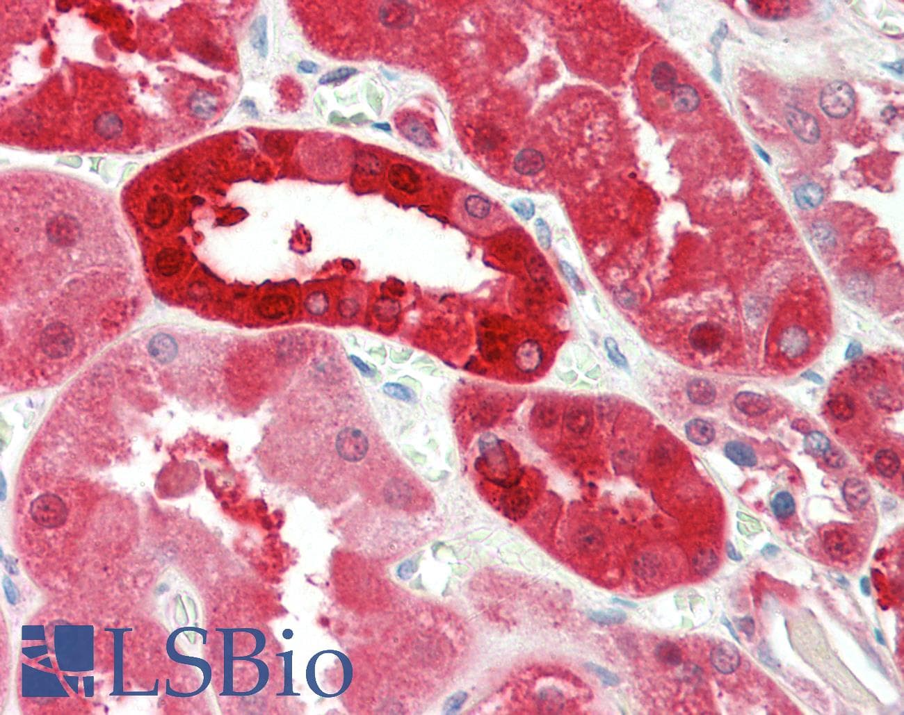 IHC-plus™ PNP / Nucleoside Phosphorylase Antibody (aa142-153)
