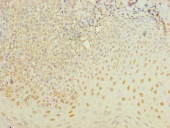 Polyclonal Rabbit anti-Human ZBTB6 Antibody (IHC, WB)