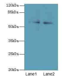 TRIM55 / MURF2 Antibody