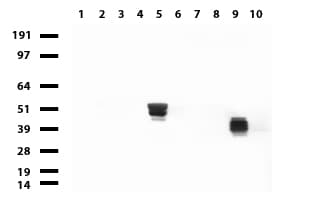 Monoclonal Mouse anti-Human KRT20 / CK20 / Cytokeratin 20 Antibody (clone UMAB167, Carrier-free, IHC, WB)