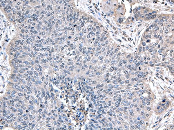 ZFAND5 Antibody