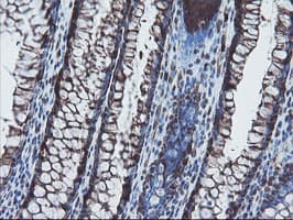 Monoclonal Mouse anti-Human SKIL / SNO / SnoN Antibody (clone OTI3E2, IHC, WB)