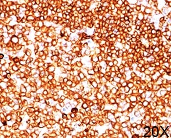 CD79A / CD79 Alpha Antibody (aa202-216, clone JCB117, Ready-to-Use)