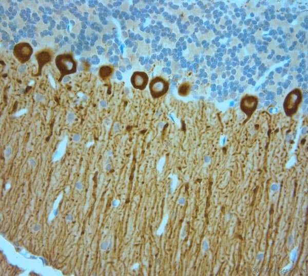 Polyclonal Rabbit anti-Human ITPR1 / IP3 Receptor Type 1 Antibody (aa700-750, IHC)