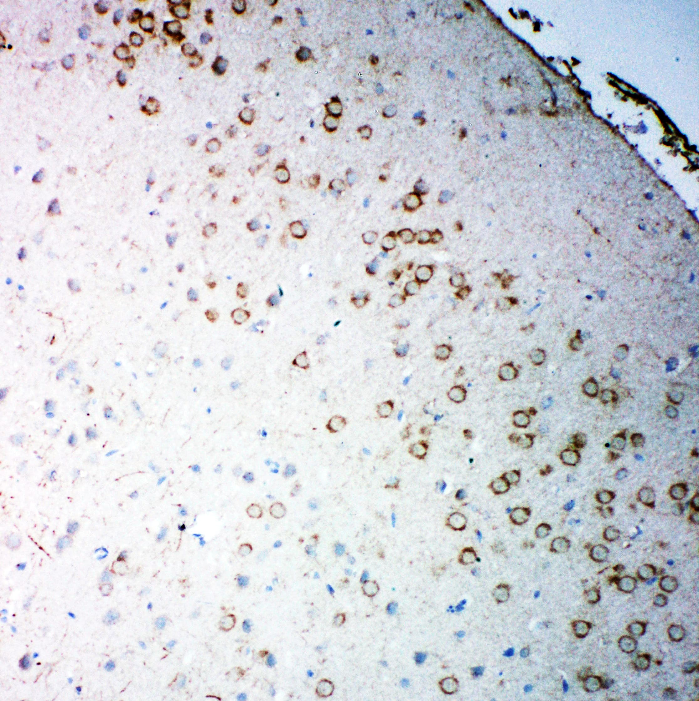 CHRM2 / M2 Antibody (C-Terminus)