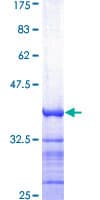 Human ATP2B1 / PMCA1 Protein (Recombinant GST, N-terminus)