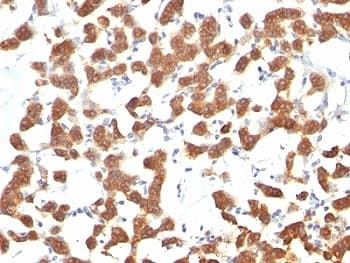 Cytokeratin 1+8 Antibody (clone C-04 or Ks18.04)