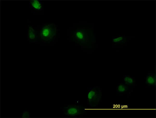 IHC-plus™ AML1 / RUNX1 Antibody (clone 2C10)