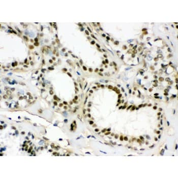 EWSR1 / EWS Antibody (aa369-399)