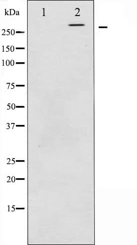 Polyclonal Rabbit anti-Human MTOR Antibody (IHC, IF, WB)