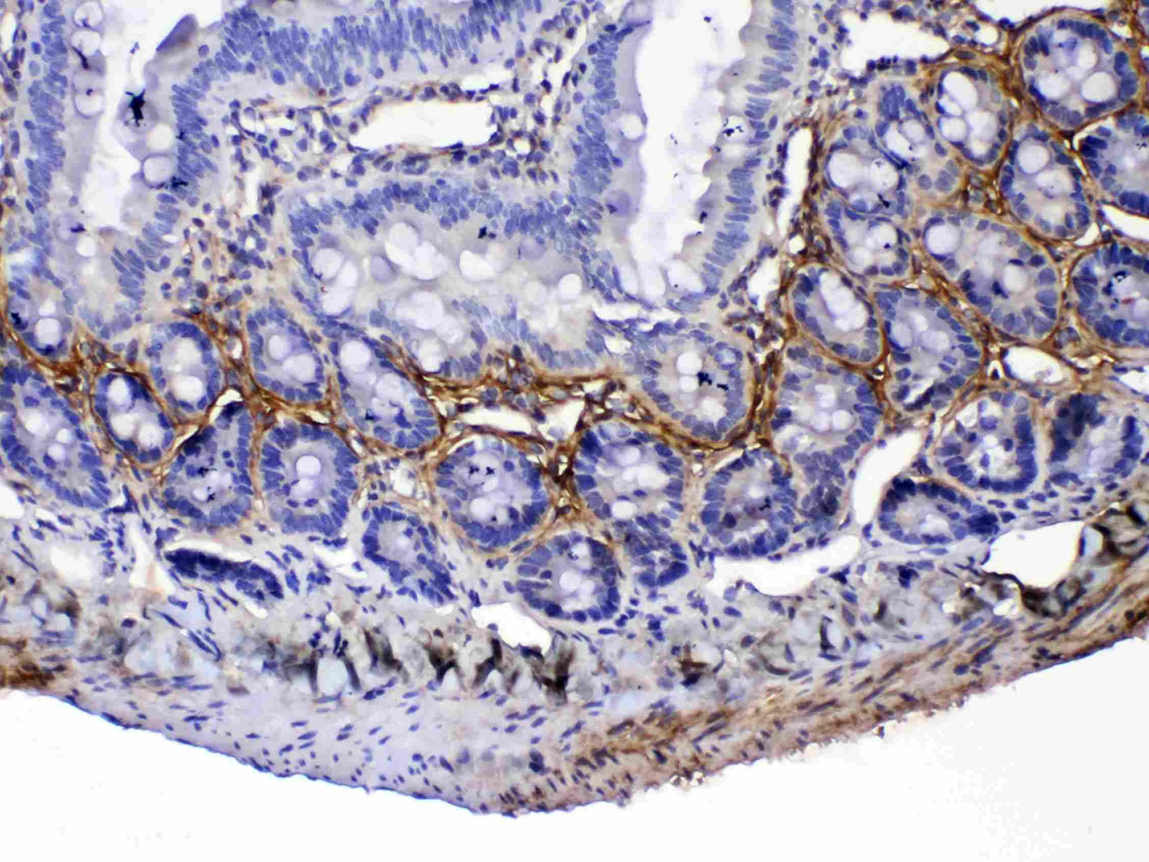 Polyclonal Rabbit anti-Rat POSTN / Periostin Antibody (IHC, WB)